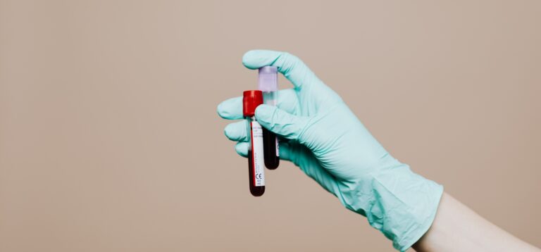 Zaproszenie na badania a RODO